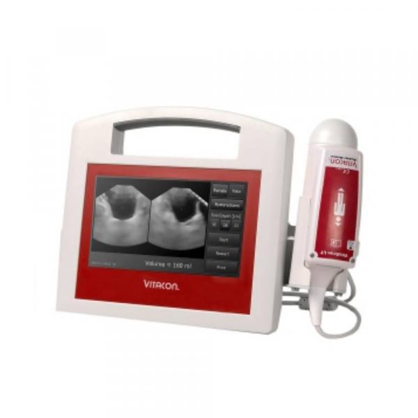 Le Bladder scanner vésical portable Vitascan avec sonde et tablette VITACON